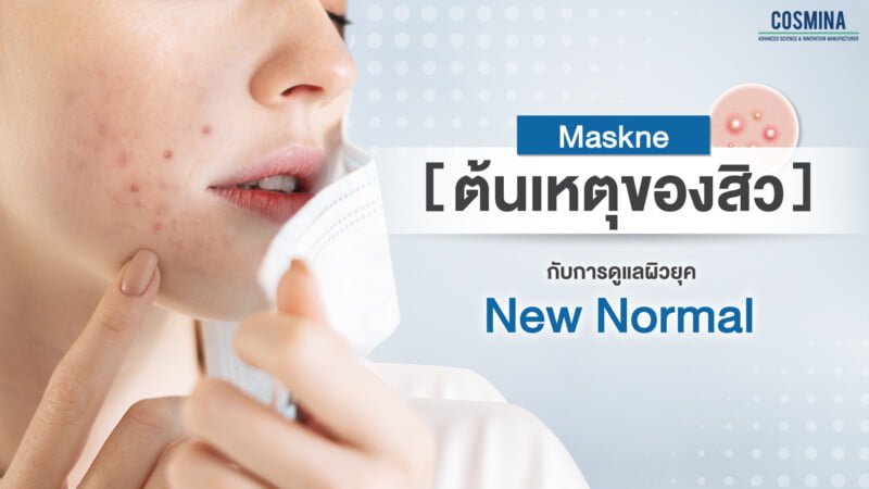 maksne ต้นเหตุของสิว