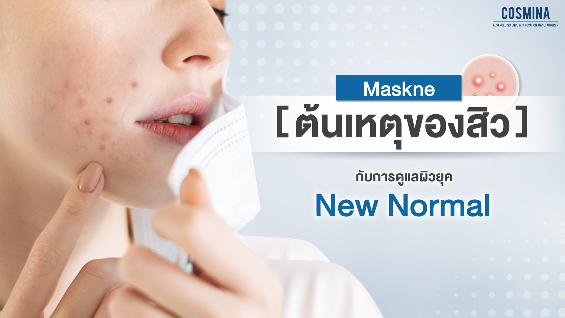 ต้นเหตุสิว Maskne 