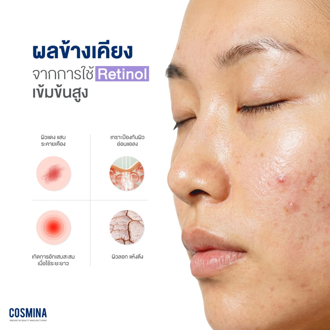 ผลค้างเคียง retinol